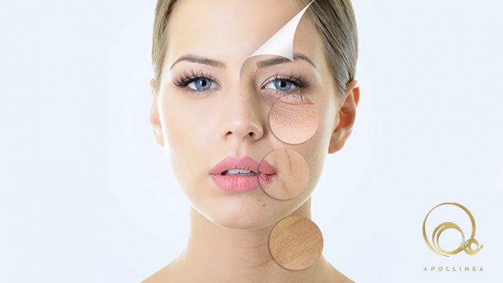 Invecchiamento cutaneo: perché accade e cosa fare