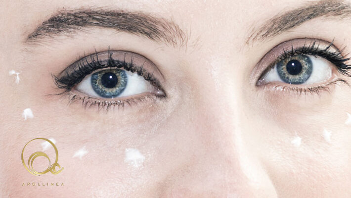 Contorno occhi: perché invecchia prima