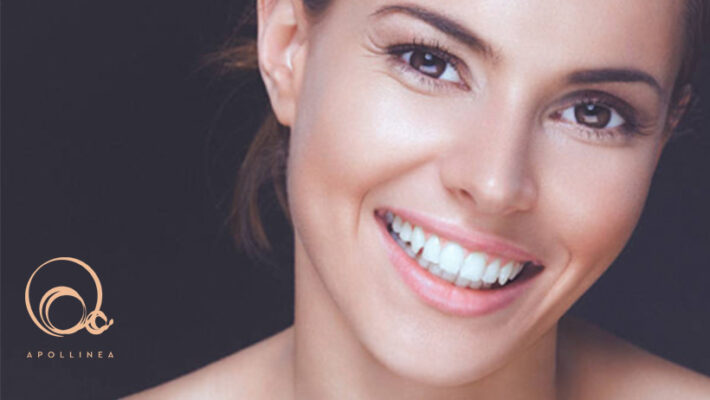 Rughe a 30 anni: cosa fare per prevenirle