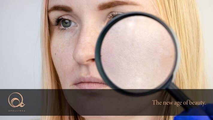 Pori dilatati: come ridurre le dimensioni con i prodotti giusti