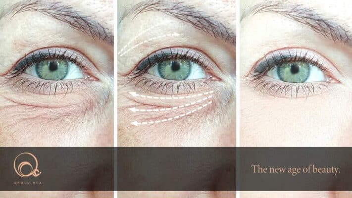 Rughe sotto gli occhi: i prodotti giusti per ridurle