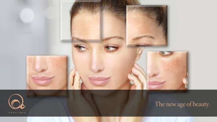 Pelle screpolata: curala con Apollinea