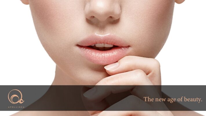 Rughe nasogeniene: quali sono e come combatterle