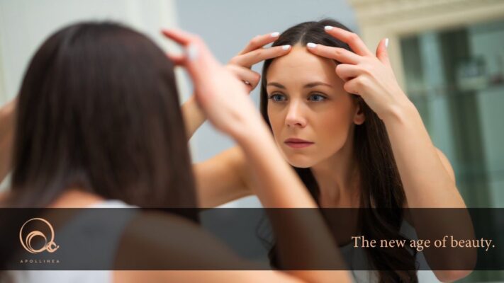 Rughe della fronte: come prevenirle e curarle