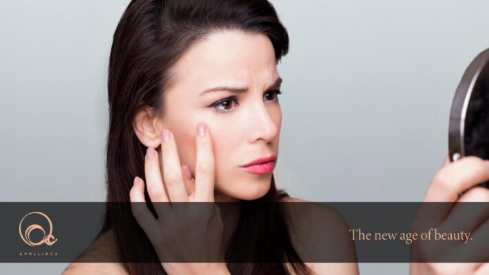 Rughe di espressione: i prodotti per eliminarle