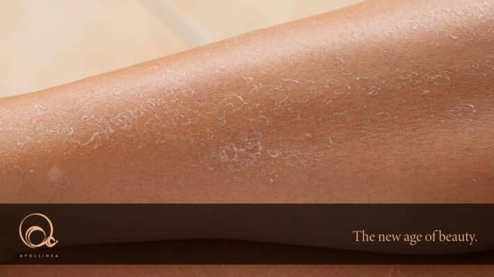 Idratare la pelle dopo l’estate: ecco come