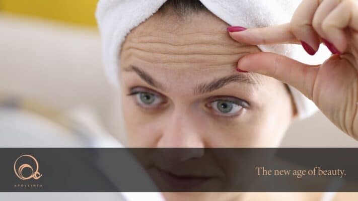 Rughe di espressione: quali sono e come eliminarle