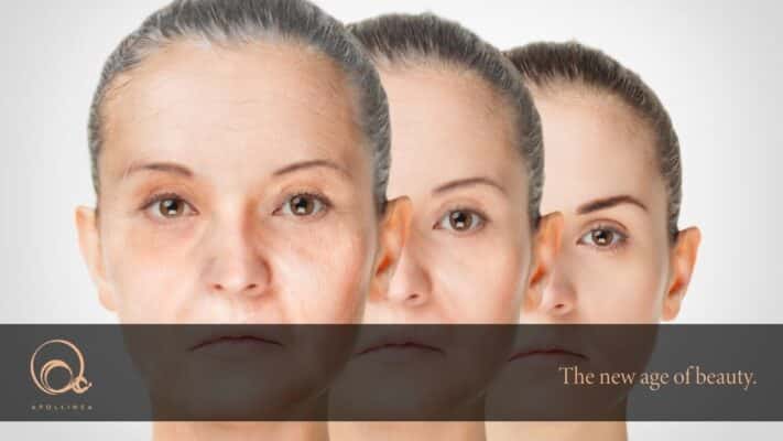 Radicali liberi: perché sono causa di invecchiamento precoce