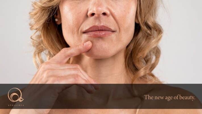 Solchi naso labiali: quali sono e come prevenirli