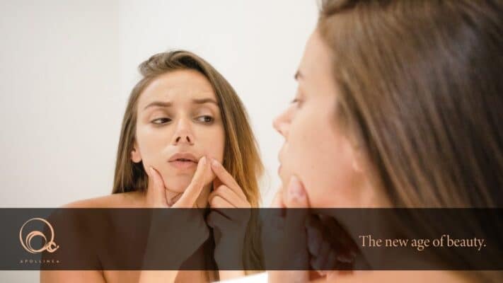 Brufoli e stress, sono collegati?