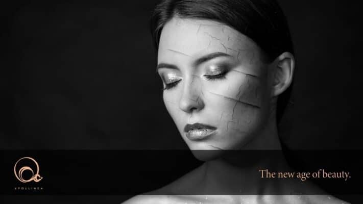 Pelle screpolata: ecco cosa fare