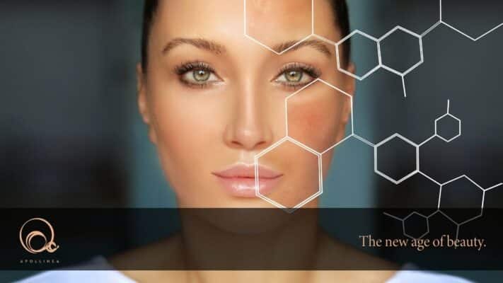 Iperpigmentazione cutanea: come ridurre le macchie scure