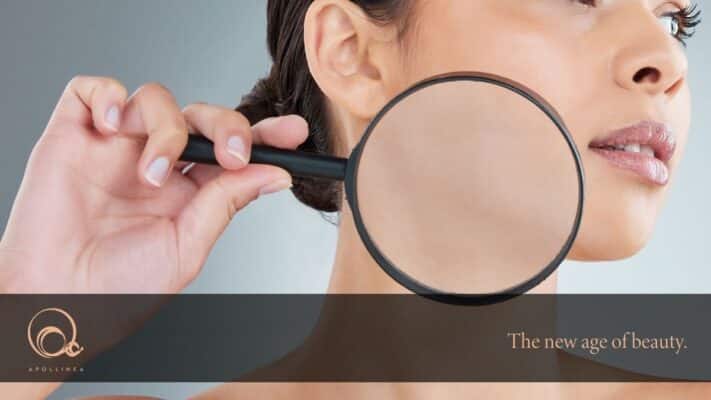 Strati della pelle: quali sono e che funzione hanno