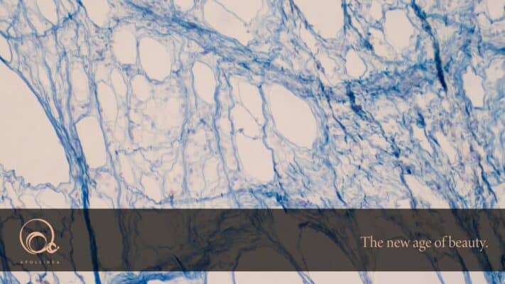 Fibroblasti pelle: che funzione hanno