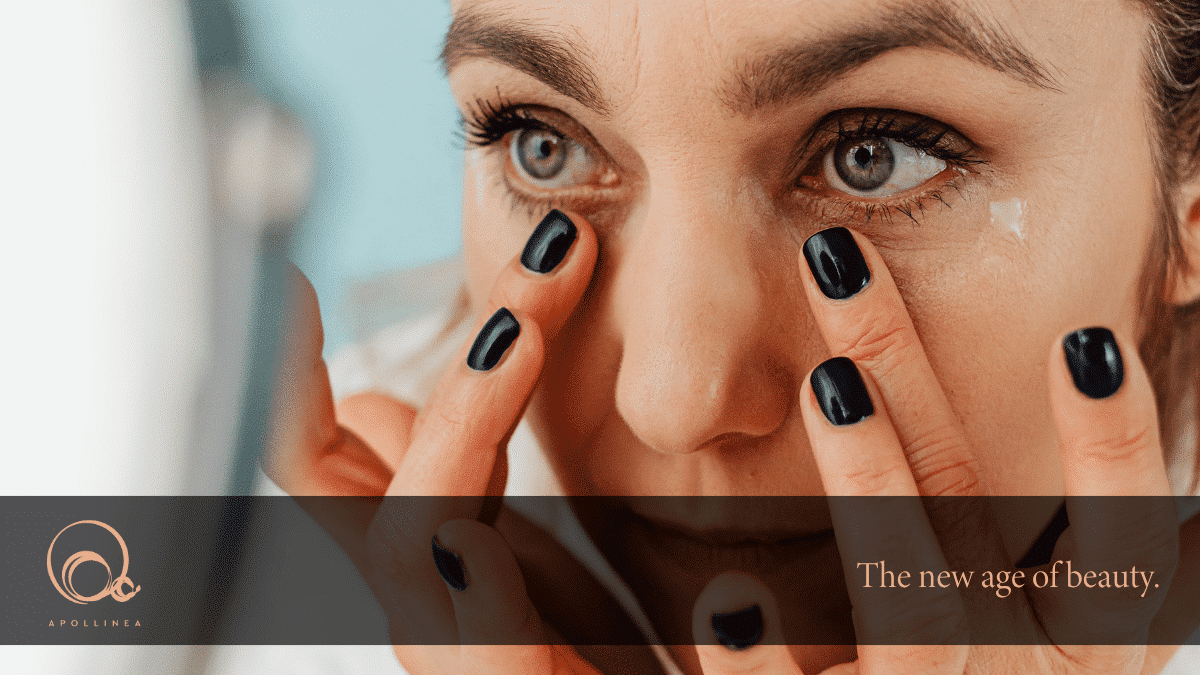 Occhiaie: rimedi naturali per eliminarle