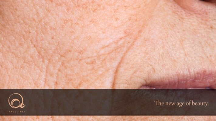 Skincare over 50: come ridare tono all'ovale del viso senza chirurgia